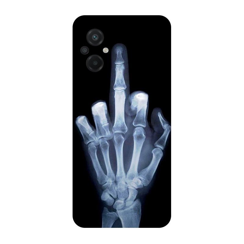for Poco M5 2022 4G Case Footb - Phone Cases Liverpool 评论和价格